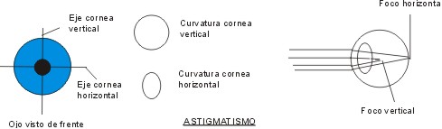 Astigmatismo.jpg (14641 bytes)