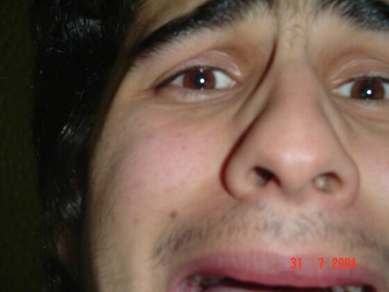 Click to See Next Image
