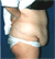 abdomenpre2[1].gif (2444 bytes)