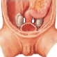 testiculos en abdomen
