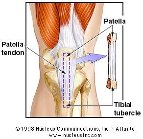 For a more info on ACL repair.. check it out