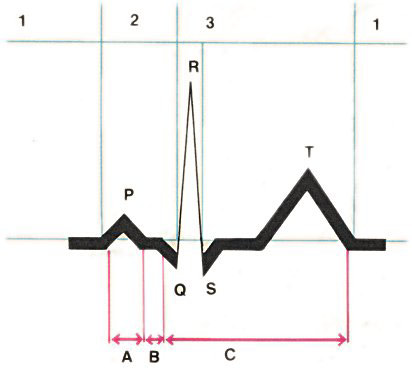 Eletrocardiograma
