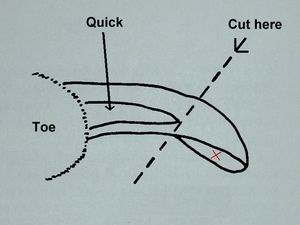 Diagram of nail