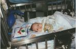 After 2nd Surgery
2 1/2 Months
