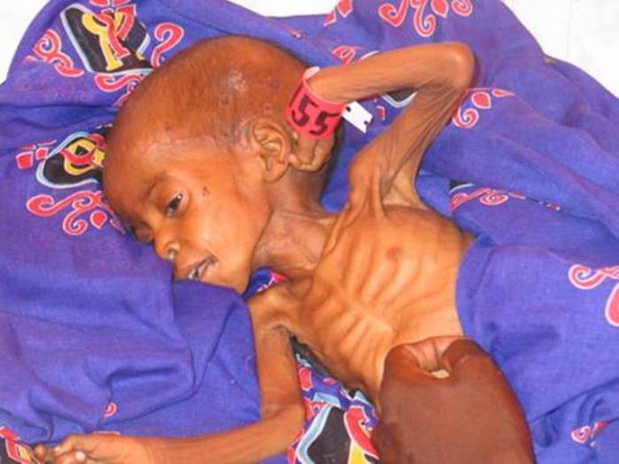 Hope of Darfur