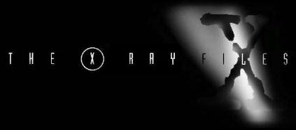 Archivos de Rayos X