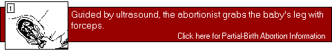 [Partial Birth Abortion Information]