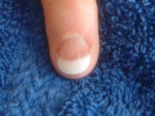 After