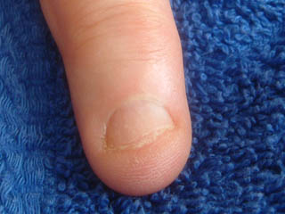 Before