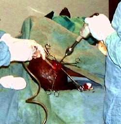 Teaching Craniotomy