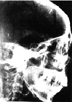 Thuya ( S. XIII  a.C.)