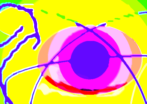 Adaptive Eye