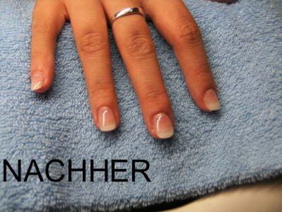 Nachher 1