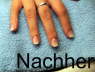 Nachher 2