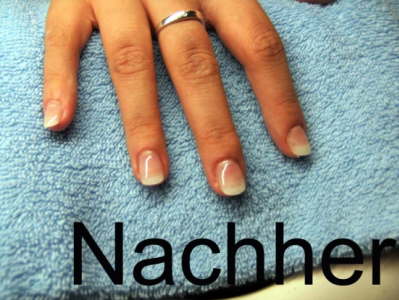 Nachher 2