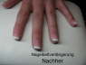 Nagelbettverlngerung Nachher