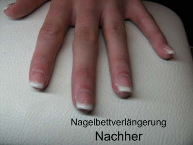 Nagelbettverl�ngerung Nachher