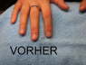 Vorher 1
