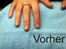 Vorher 2