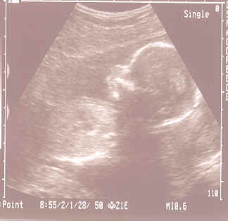 baby.bmp (306286 bytes)