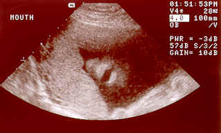 baby2.bmp (186358 bytes)