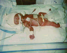 Here is Carolynn at 3 hours old.  