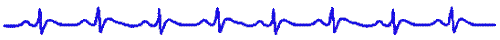 Blue Rhythm