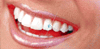 Tooth jewellery (skyce)