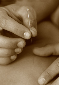 Hands with an Acupuncture Needle
