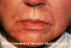 Labios1.jpg (60748 bytes)