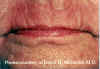 Labios3b.jpg (73731 bytes)