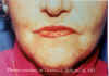 Labios4a.jpg (66124 bytes)