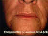 Labios5.jpg (54329 bytes)
