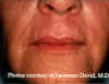 Labios5a.jpg (60652 bytes)