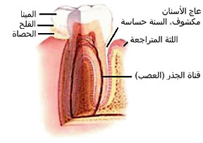 Sensitive Teeth