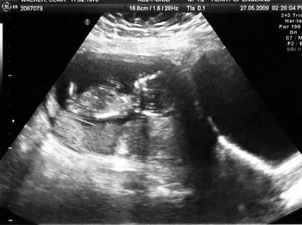 babywalker13weeks.jpg