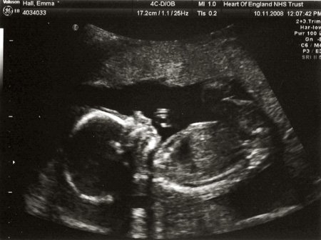 babyhall2.jpg