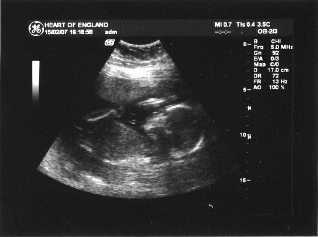 clairsandadriansbaby.jpg