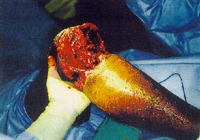 Earl's Leg #2