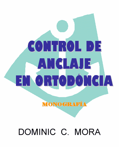 Control de anclaje