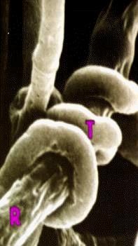 Trichoderma en accin
