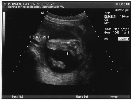 It's a girl