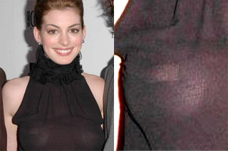 Anne Hathaway