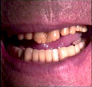 denturea.jpg (17781 bytes)