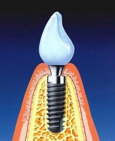 Saúde dental