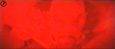 The Mings-Face meteor.