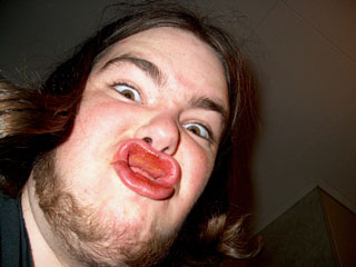 Henke!