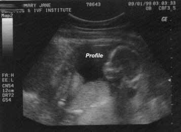 16 Weeks