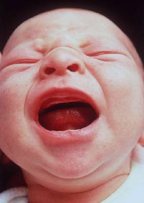 [Baby Cry]