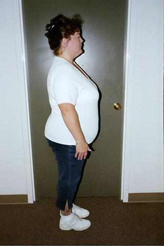 BMI 39.5 Pre-op